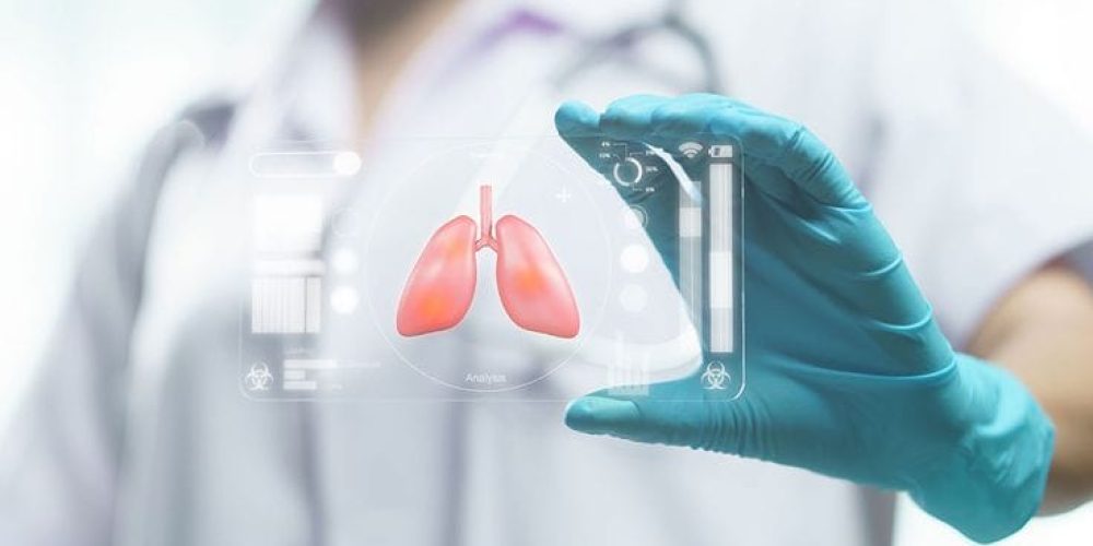 Lung Transplant By Synovia Health Lung Transplant By Synovia Health