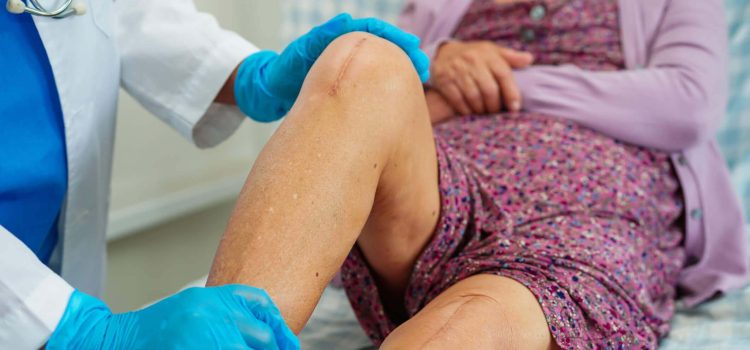 Best Hospital for Knee Replacement in India