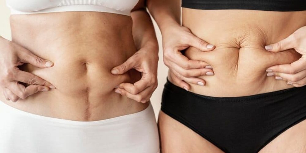 close-up-women-holding-belly_23-2148889301 close-up-women-holding-belly_23-2148889301