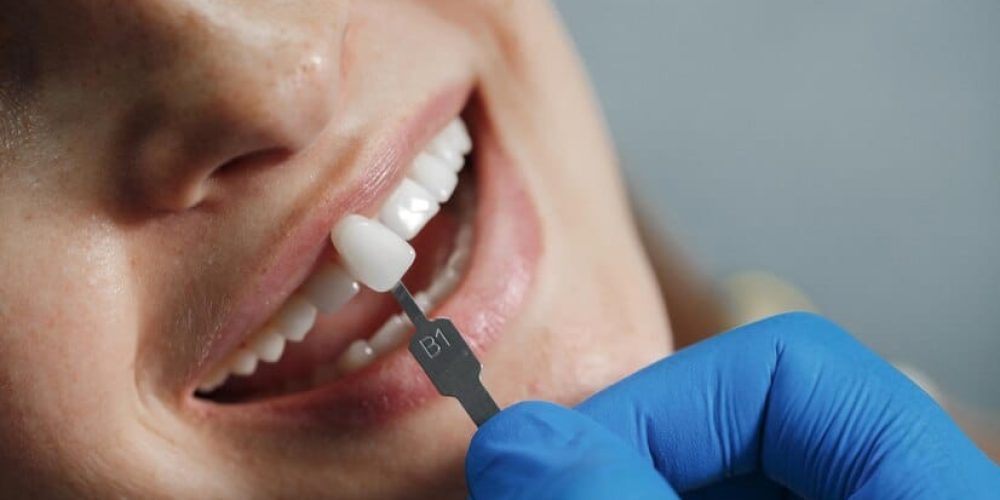 dentist-whiting-teeth_624325-1916 dentist-whiting-teeth_624325-1916