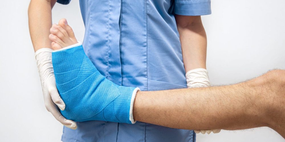 Female doctor in a blue medical gown checking broken leg on male patient. Close up of a man's leg in a cast and a blue splint after bandaging in a hospital.