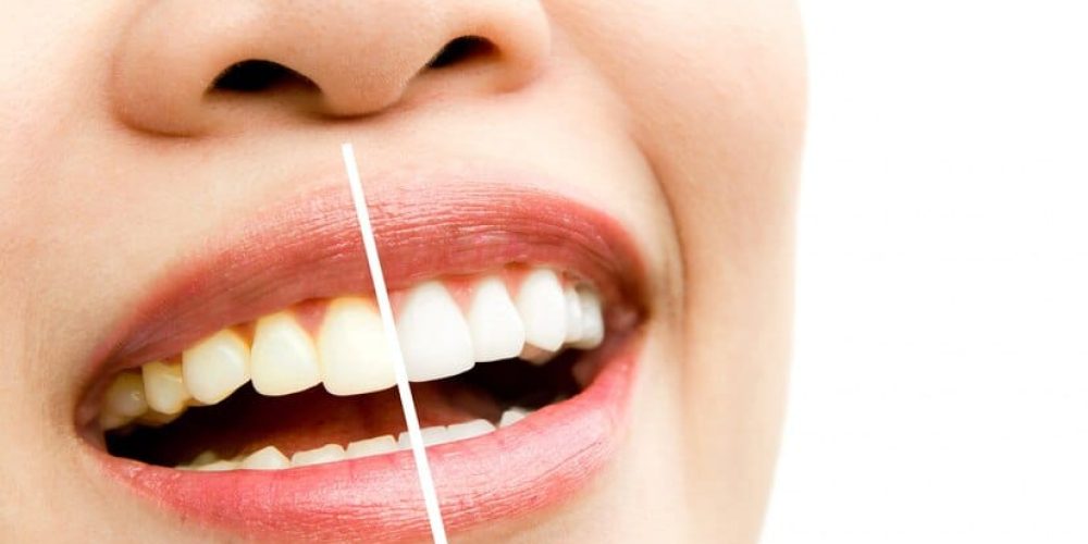 woman-whitening-treatment_1232-185 woman-whitening-treatment_1232-185